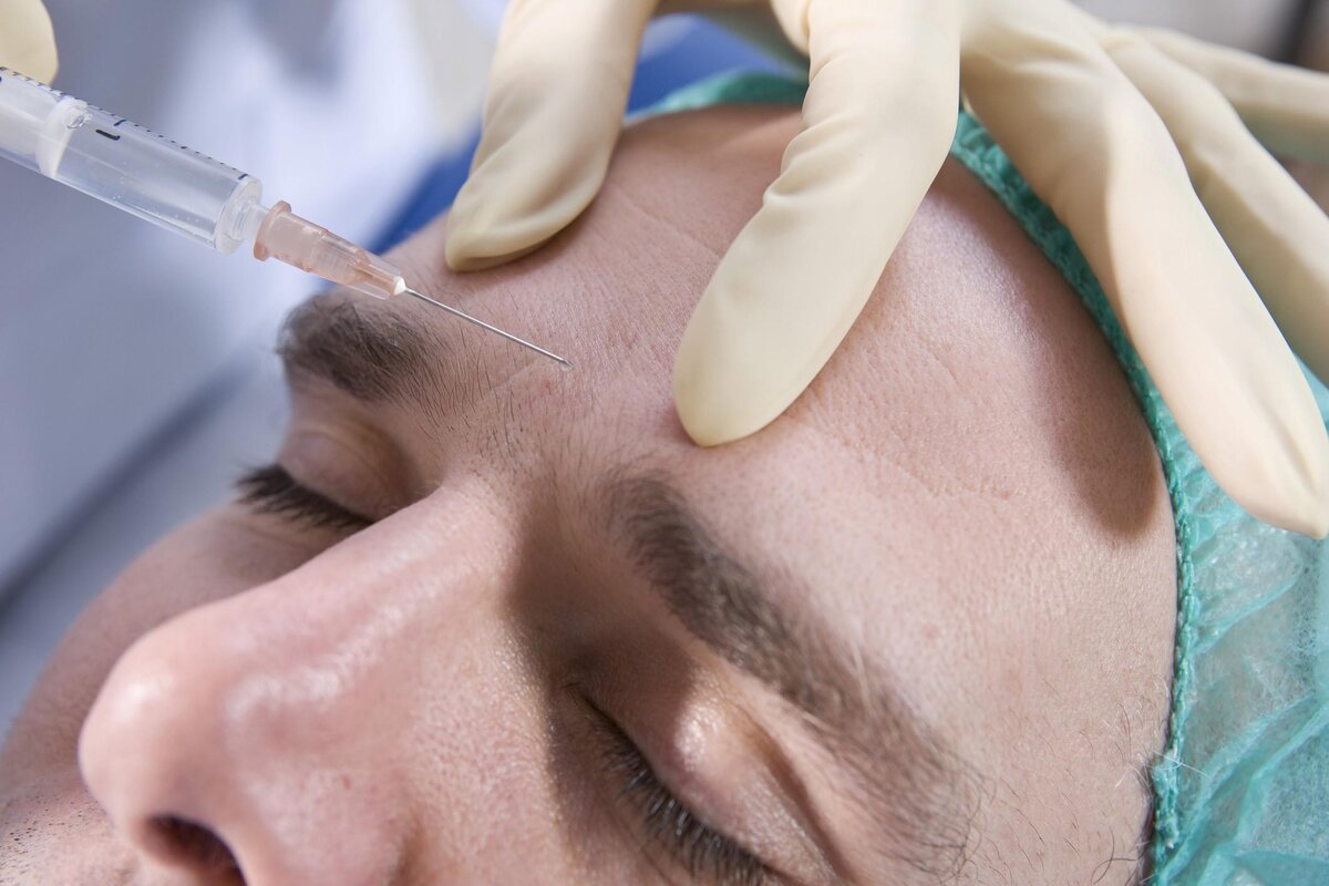 Procedimento de estética facial - Naturalização facial com técnica avançada de preenchimento